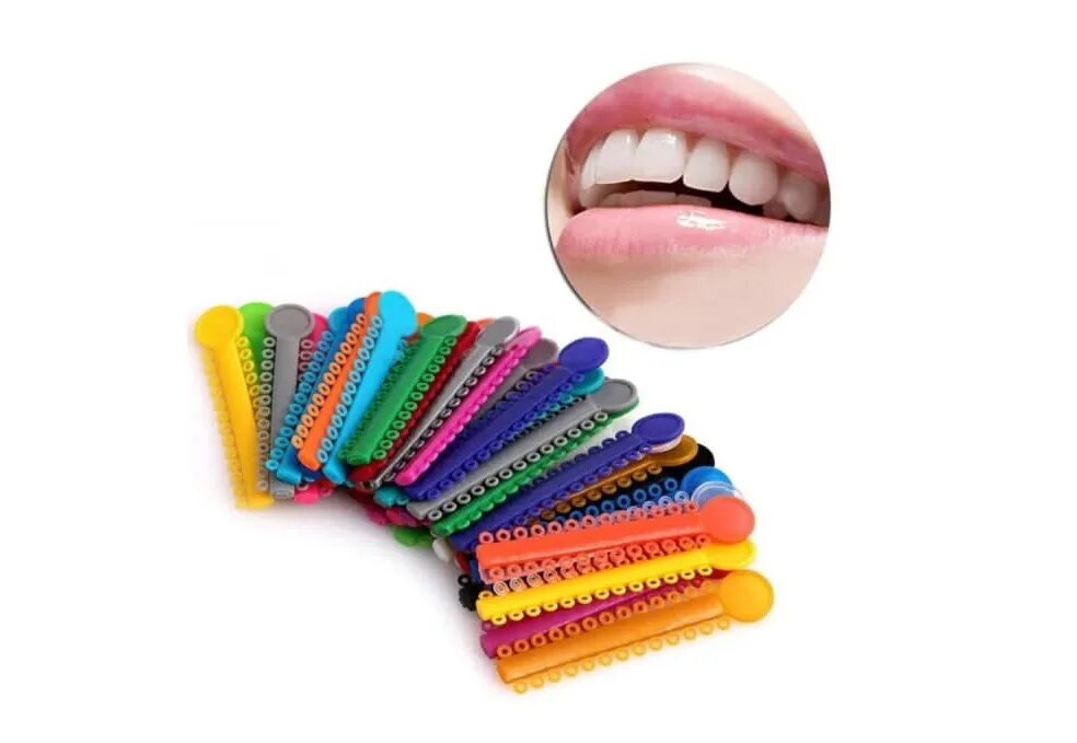 Как называются штучки которые крепятся на. Резинки для зубов. Ортодонтические резинки. Эластичные резинки для зубов.