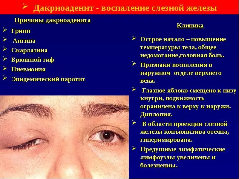 Конъюнктивит мкб 10 у взрослых