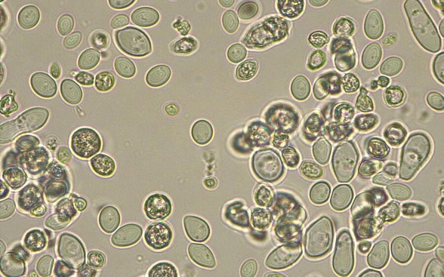 Дрожжевые клетки в моче повышены. Дрожжи Saccharomyces cerevisiae. Клетки Saccharomyces cerevisiae. Дрожжей Saccharomyces cerevisiae микроскопия. Пекарские дрожжи Saccharomyces cerevisiae.