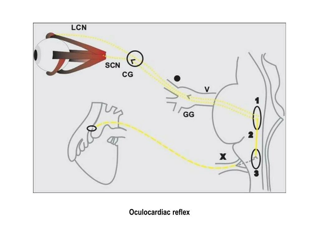 Aschner Reflex Oculocardiac Reflex. Гастролингвальный рефлекс схема. Гастро лингвпльный рефлекс. Reflex Arc of the Oculocardiac Reflex.