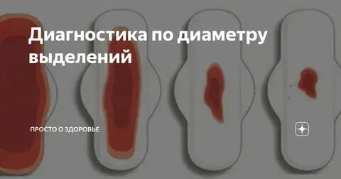 Могут ли быть скудные месячные при беременности
