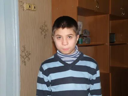Дцп лицо
