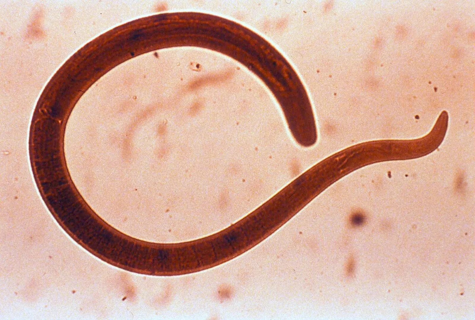 Паразитические черви имеют. Анкилостома (Ancylostoma duodenale). Кошачьи глисты анкилостома. Нематода Caenorhabditis elegans.