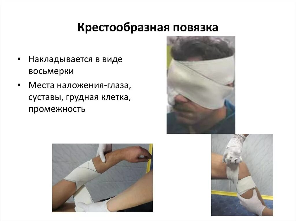 Техника наложения крестообразной повязки. Крестообразная повязка. Циркулярная повязка на грудную клетку. Наложение крестообразной повязки на грудь.