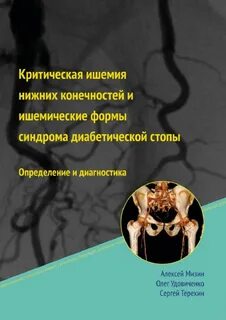 Ишемическая конечность