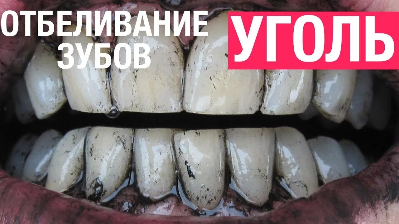 Отбелить зубы углем. Отбелить зубы активированным углем. зубы после отбеливания углём.