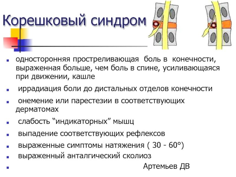 Боль в спине усиливается при движении