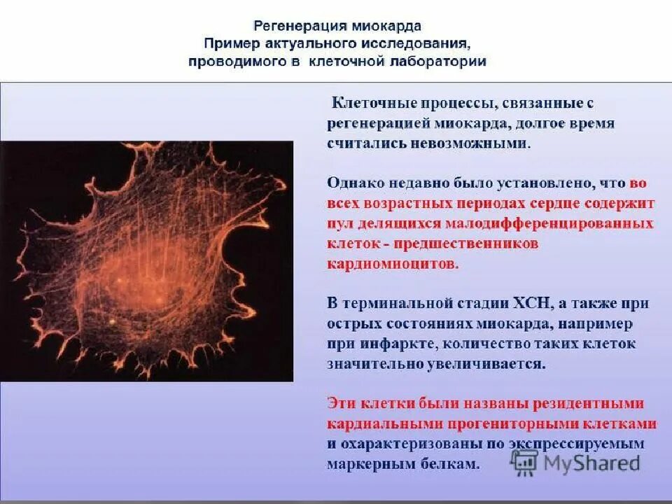 Сильная регенерация. Регенерация миокарда. регенерация клеток миокарда. регенерация миокарда гистология. репаративная регенерация сердечной мышцы.