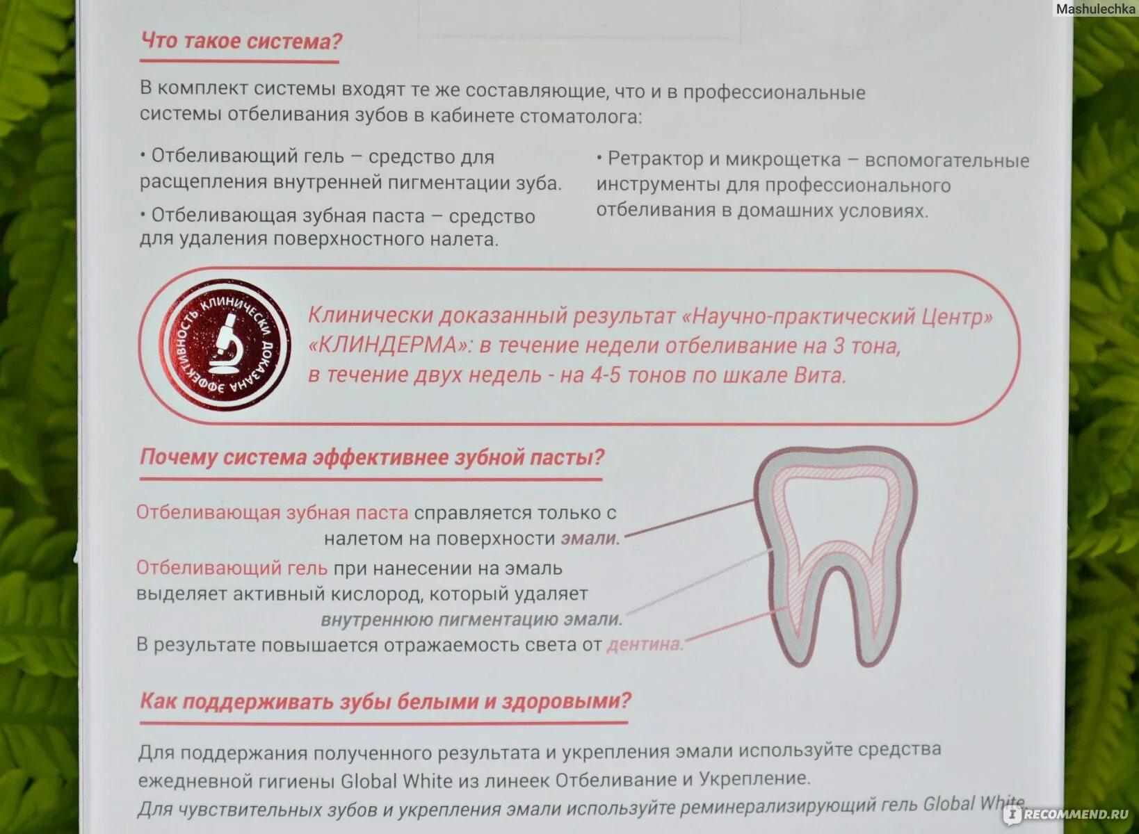 Сильная чувствительность зубов