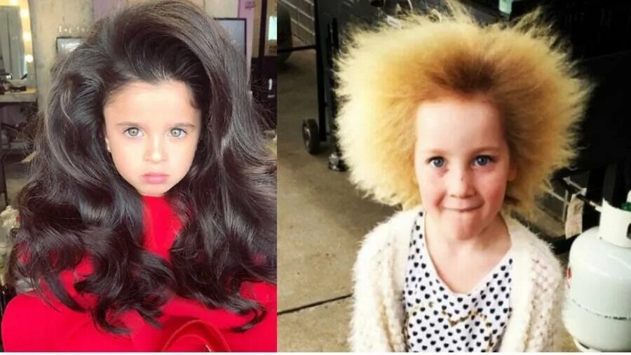 Могут ли дети родиться с волосами. Синдром нерасчесываемых волос. Нерасчесанные волосы у девочек. Дети которые родились с длинными волосами. Редкие волосы у ребенка.