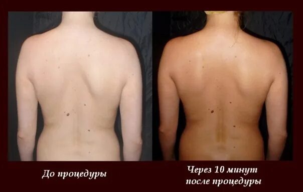 Можно ли мыться сразу после солярия. Эффект после первого сеанса солярия. солярий эффект до и после. солярий после первой процедуры. солярий до и после результаты.