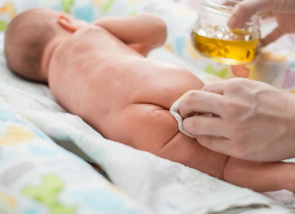 Лечение трещин у ребенка. Опрелости у новорожденных. Обработка кожных складок новорожденного. Профилактика опрелостей у новорожденных.