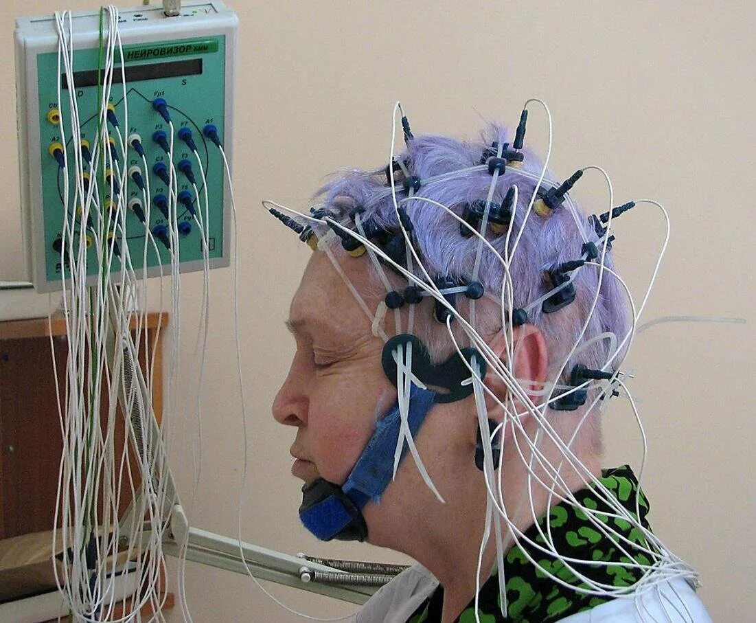 Ээг оренбург. ЭЭГ РЭГ Эхо. Электроэнцефалография головного мозга (ЭЭГ). РЭГ И ЭЭГ. ЭЭГ И Эхо ЭГ что это.