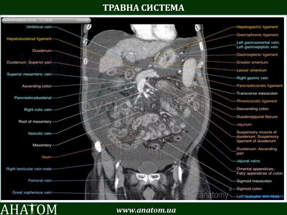 Анатомия собаки органы брюшной полости. Топография органов брюшной полости собаки. Брюшная полость кошек. Строение брюшной полости кота. Строение внутренних органов собаки брюшная полость.