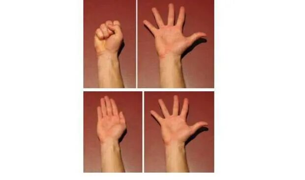 Stabilization of Broken Finger Stock Photo - Image of emergency, doctor: 8021299