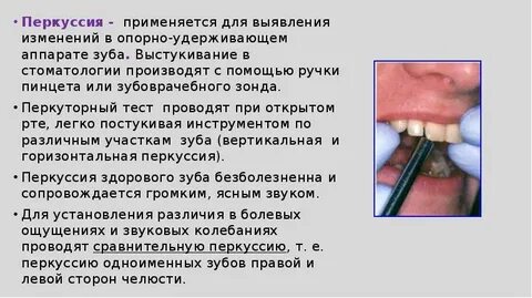 Перкуссия зуба