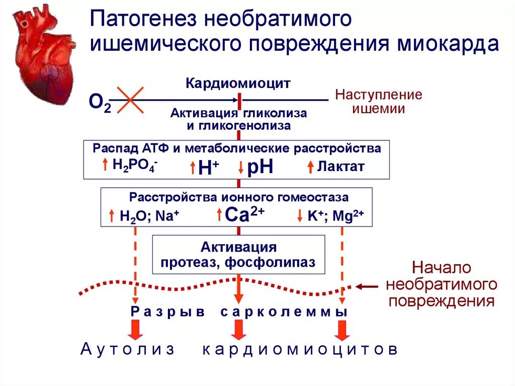 Патогенез повреждения. Механизмы повреждения кардиомиоцитов при ишемии. Механизм развития инфаркта миокарда. Механизм повреждения кардиомиоцитов при инфаркте миокарда. Повреждение кардиомиоцитов патогенез.