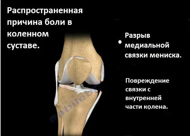 Болит под коленом что это может быть. Внутренняя сторона коленного сустава. Болит колено сбоку с внутренней. Боль в коленке с боку с внутренней стороны. Болит колено сбоку с внутренней стороны при ходьбе.