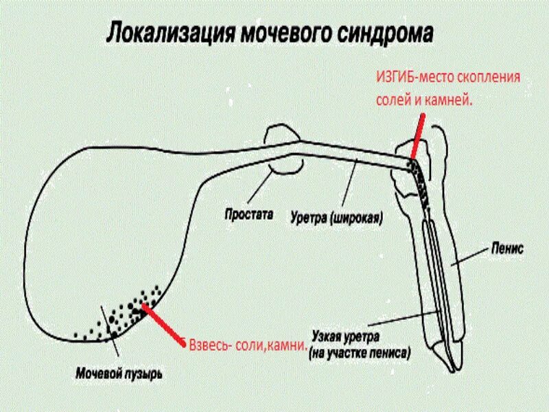 Операция мочевой пузырь собака. Промежностная уретростомия ход операции. Операция у кота уретростомия. Уретральный катетер для кота схема. Уретростомия кота схема.