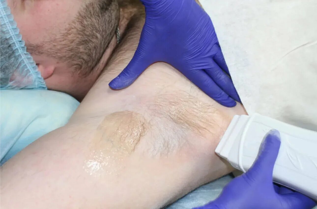Мужской шугаринг бикини. Мужская депиляция глубокого бикини видео. Мужская депиляция бикини. Мужская депиляция. Мужская депиляция глубокого бикини видео.