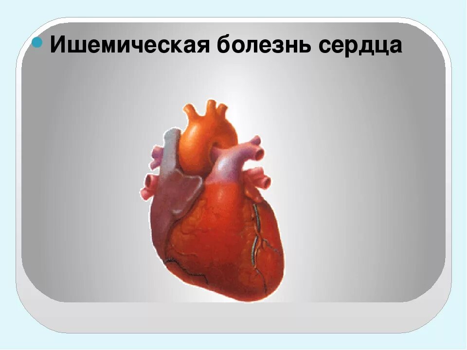 Ишемия боковой. Ишемическая болезнь сердца.