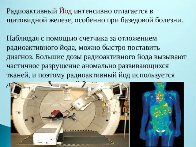 Радиоактивный йод. Терапия радиоактивным йодом щитовидной железы. Радиоактивный йод 131. Радиоактивный йод щитовидная железа.