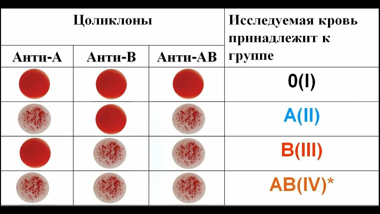 Как отличить кровь. Цоликлон группа крови резус. Определение группы крови по цоликлонам таблица. Цоликлоны для определения резус фактора крови. Как определить группу крови и резус-фактор с цоликлонами.