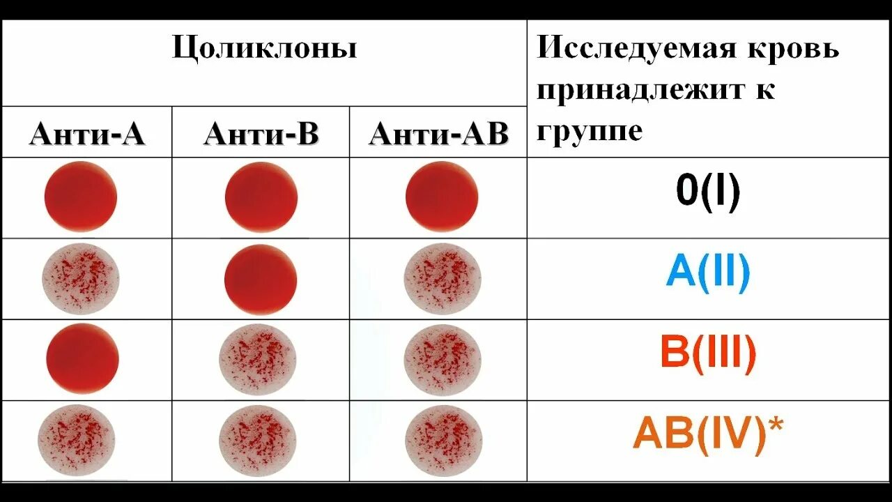 Как определяется группа. Определение группы крови по цоликлонам. определение группы крови по цоликлонам таблица. группа крови и резус фактор цоликлоны. определение гр крови цоликлонами алгоритм резус фактор.