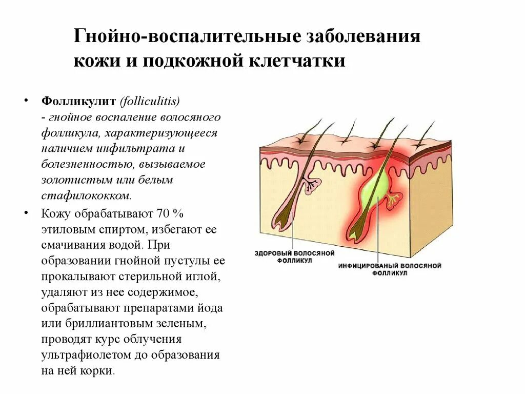 Фолликулит – воспаление волосяных фолликул.. Поверхностный фурункул. Фолликулит фурункул карбункул.