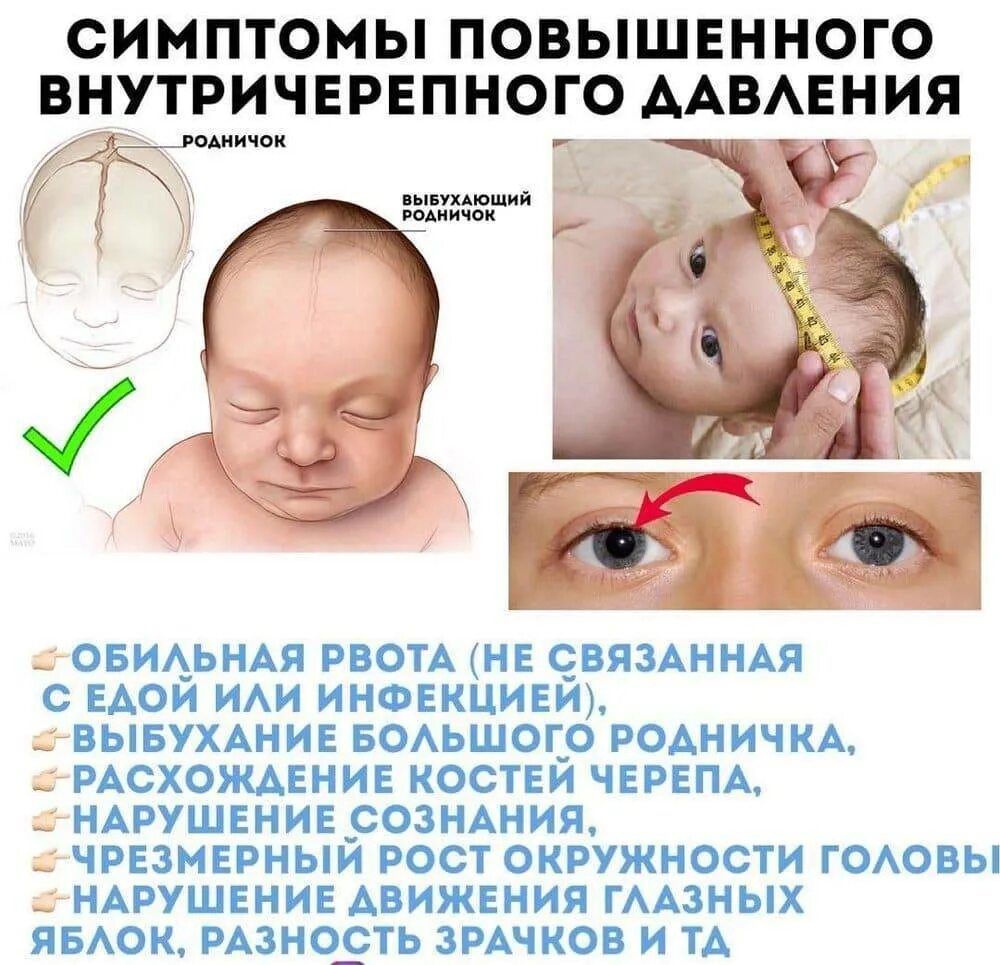 Признак черепной у детей