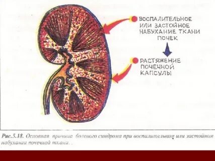 Почечная капсула системы