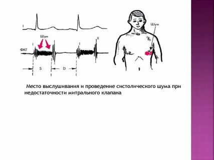 Шум место