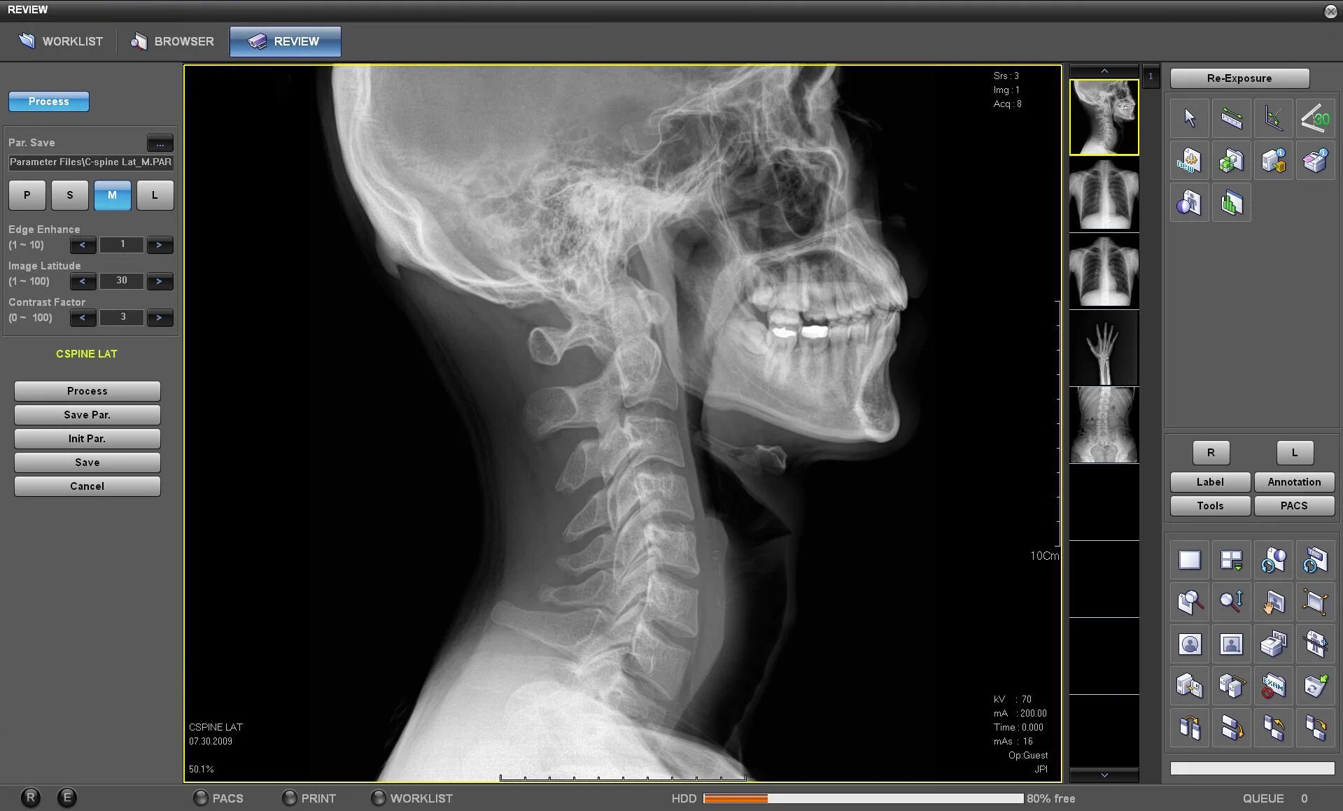 X-ray 7600. XRAY снимок. X-ray Imaging. Dicom для рентген снимка. Xray extension