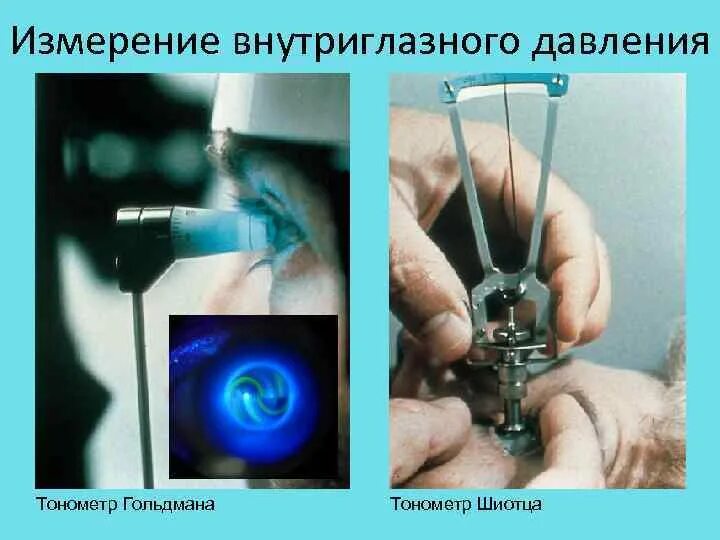 Тонометр внутриглазного давления. Аппланационный тонометр гольдмана. внутриглазное давление измерение методом шиотца. измерение внутриглазного давления алгоритм бесконтактным. тонометрия по шиотцу.