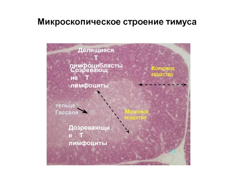 Тимус гистология. Строение тимуса гистология. мозговое вещество тимуса гистология. структуры мозгового вещества тимуса. корковое вещество тимуса гистология.