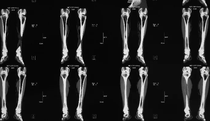 Рентген нижних конечностей. Панорамный рентген нижних конечностей. Панорамная рентгенограмма нижних конечностей.