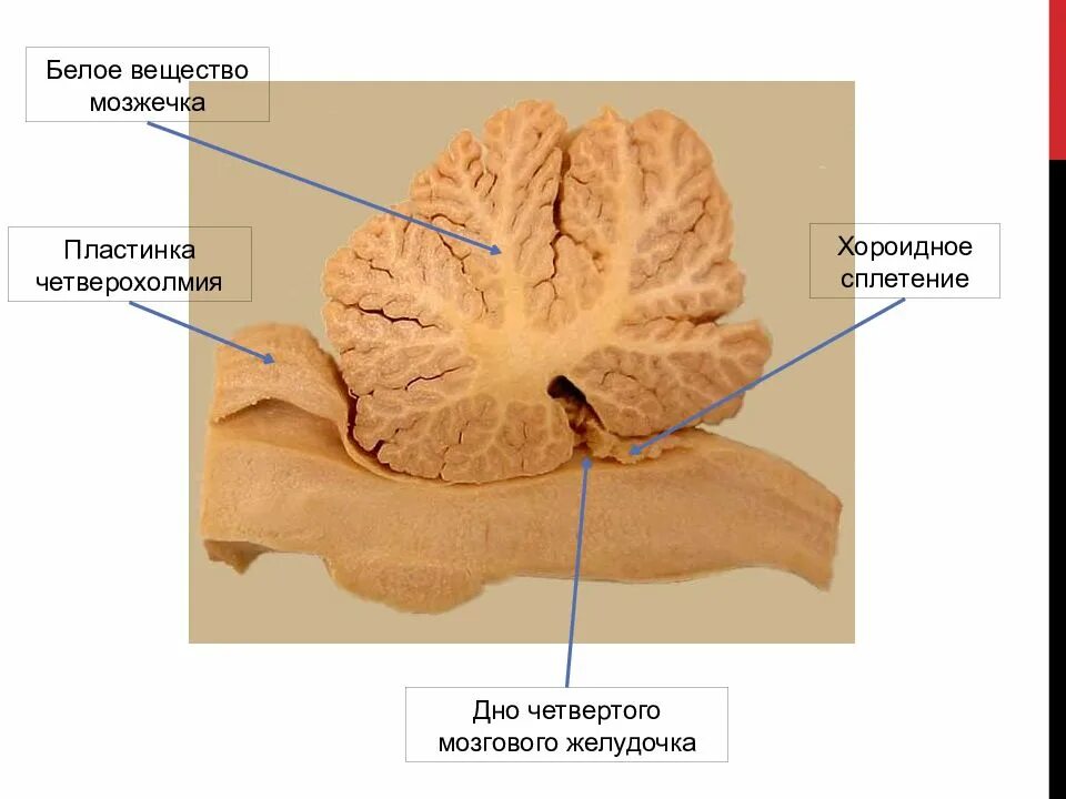 Ткань мозжечка. Мозжечок препарат анатомия. Червь мозжечка анатомия. Белое вещество мозжечка анатомия. Ядра мозжечка анатомия.