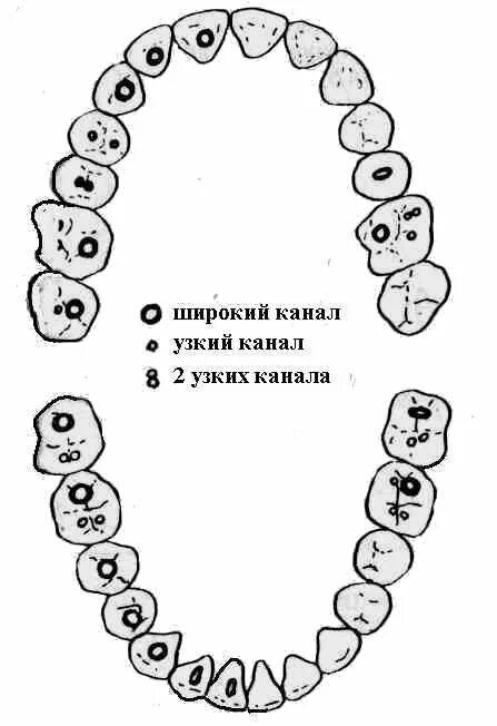 Анатомия устьев корневых каналов 26 зуба. Зубы нижней челюсти анатомия корневых каналов. Анатомия устьев корневых каналов зубов. Топография устьев корневых каналов зубов нижней челюсти.