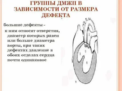 Ала с дмжп
