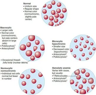 Анизоцитоз повышен у женщины