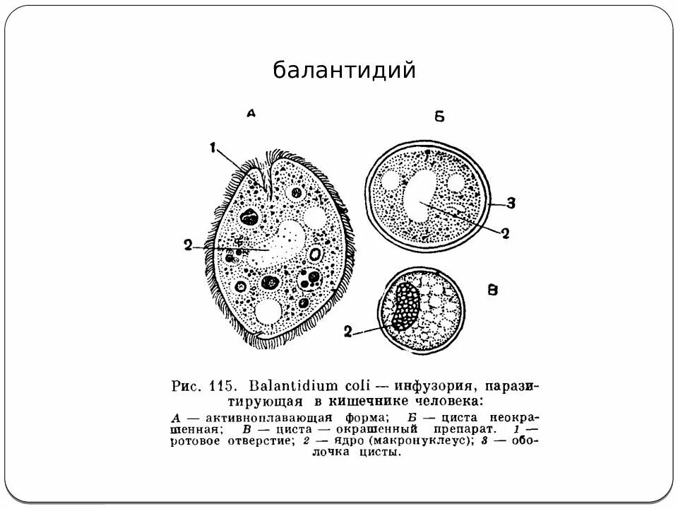Balantidium coli. Balantidium coli. Инфузория балантидий паразит. Инфузория балантидий паразит. Balantidium coli.