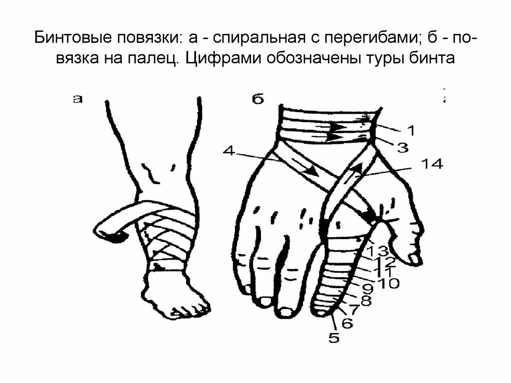 Повязка с перегибом. Десмургия наложение повязки на палец. спиральная бинтовая повязка. схема бинтования. спиральная повязка на палец.
