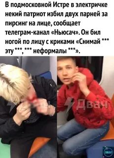 Сколько лет за избиение