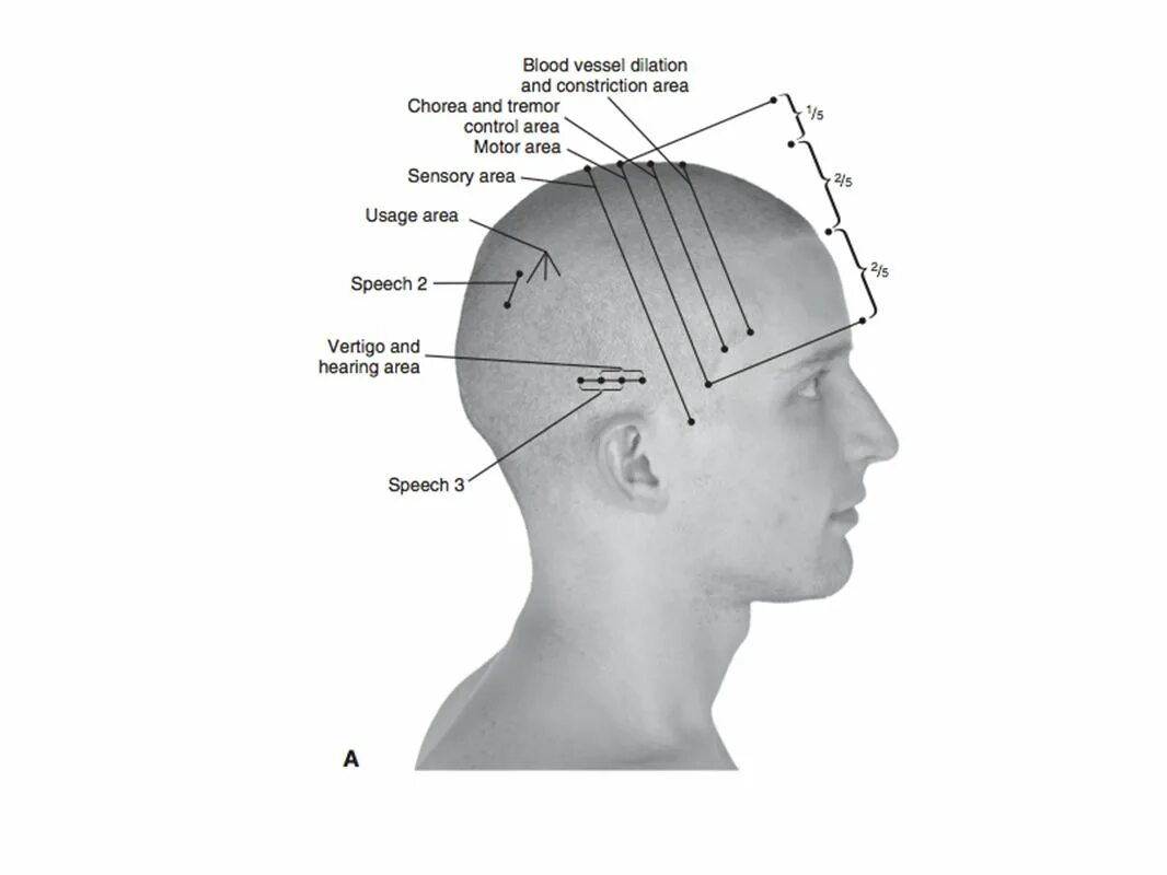 Точка мс 9. Зоны краниопунктуры на голове. Скальпотерапия зоны. Краниопунктура воздействие на зоны головы. Затылочная зона головы.