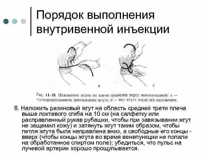 Внутривенно техника выполнения