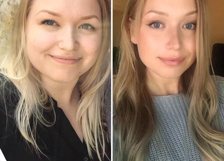 Что стало изменились. Лицо до и после похудения. Толстое лицо до и после. Худое лицо до и после. До и после похудения девушки лицо.