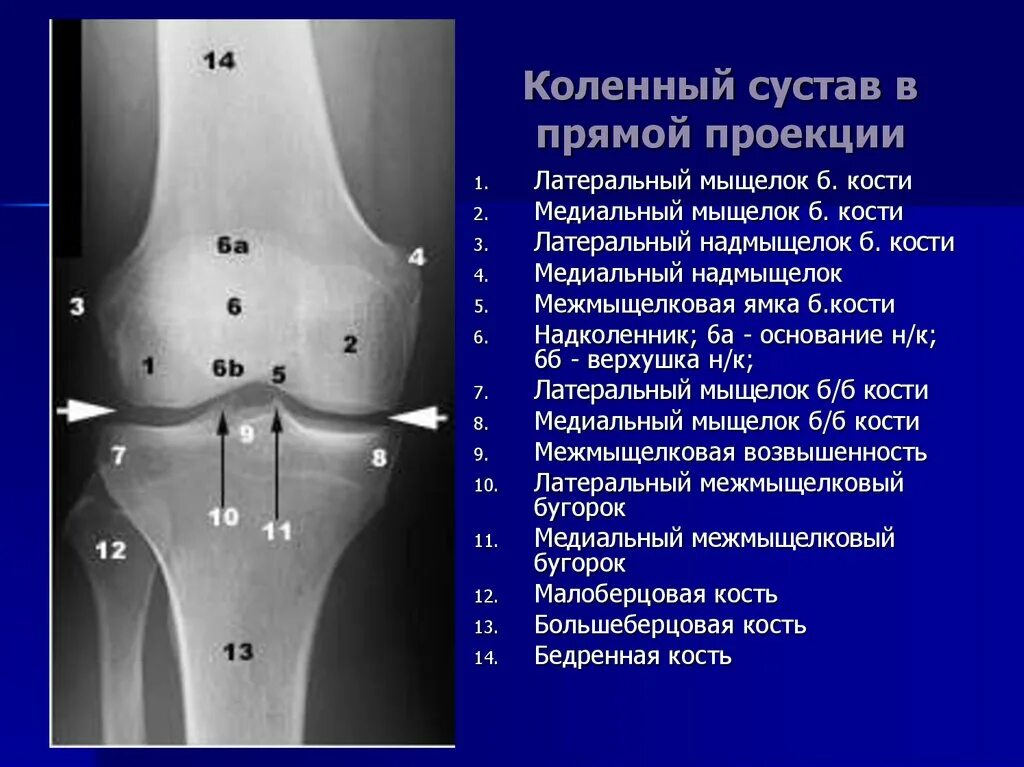 Суставной мыщелок. Коленный сустав строение анатомия рентген. Суставная щель коленного сустава норма на рентгене. Рентгенограмма коленного сустава в норме. Правый коленный сустав рентген анатомия.