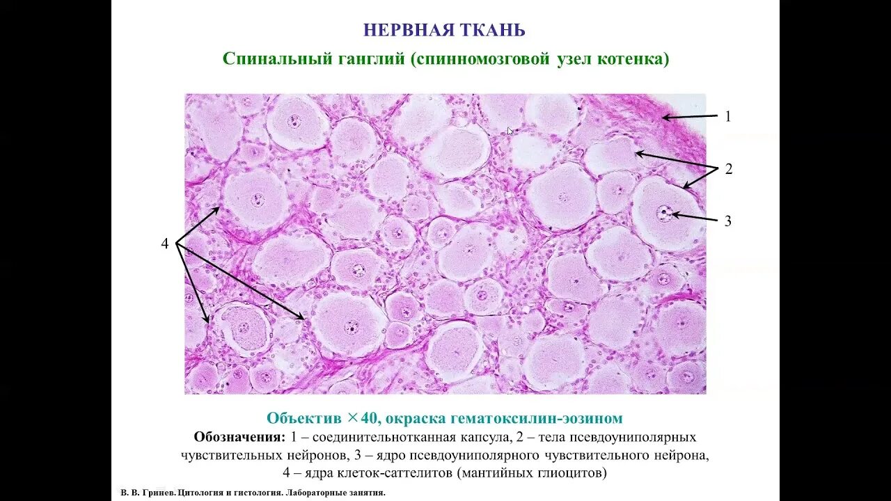 Клетки спинномозгового узла. Миелиновые волокна гистология препарат. Безмиелиновые волокна гистология препарат. Нервная ткань гистология препараты. Спинномозговой ганглий гистология.