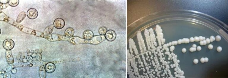 Кандида альбиканс под микроскопом. Хламидоспоры кандида. Кандида грибок микроскопия. Грибок кандида под микроскопом.