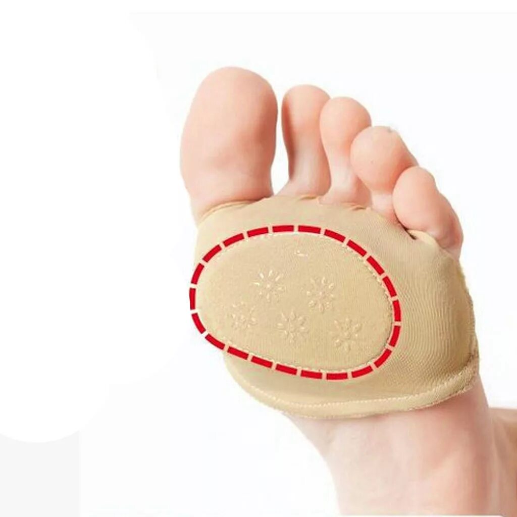 Супинатор+Metatarsal Pad. Ортопедические стельки под плюсну. Неврома Мортона стельки. Подушечка стопы.